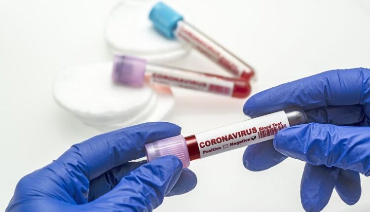 Coronavirus blood test .  Coronavirus negative blood in laboratory.